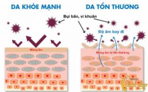 Vai trò quan trọng của lớp màng acid bảo vệ da