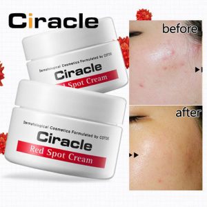 [Review] Kem trị mụn Ciracle Red Spot Cream