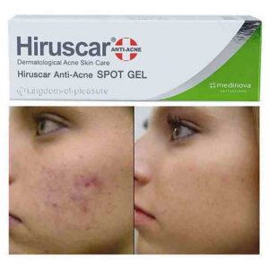 Review Kem trị mụn Hiruscar Anti Acne Spot có tốt không?