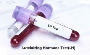 Xét nghiệm Hormone LH