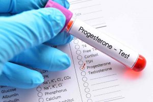 Xét nghiệm máu để xác định hàm lượng Hormone Progesterone