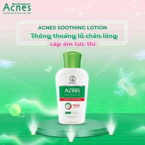Sữa rửa mặt Acnes Soothing Lotion dịu nhẹ cho da dầu mụn