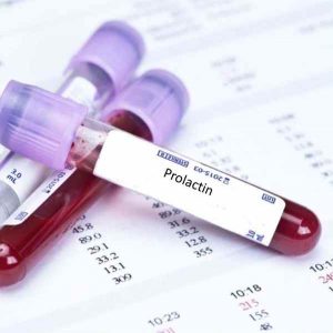 Xét nghiệm máu để xác định Hormone Prolactin